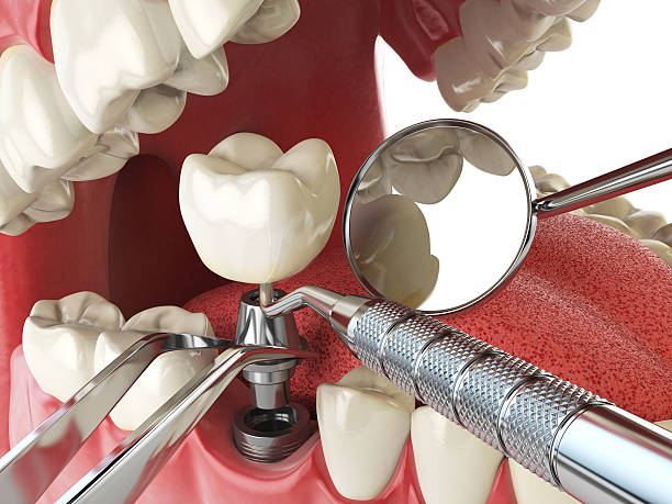 Trusted MI Emergency Dental Service Experts